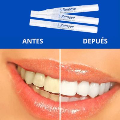 SmilePen Pro™ – Blanquea tus dientes